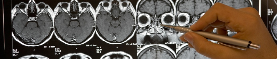 Brain Scans at at Texas Movement Disorders and Memory Center